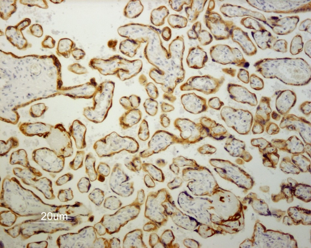 Figure 6. Indirect immunoperoxidase staining of human placenta paraffin tissue section with MUB0329P (RCK108; Mouse anti keratin 19). Dilution 1:50 and microwave pretreatment. Specific staining of the epithelial cells. No reactivity in the connective tissues.